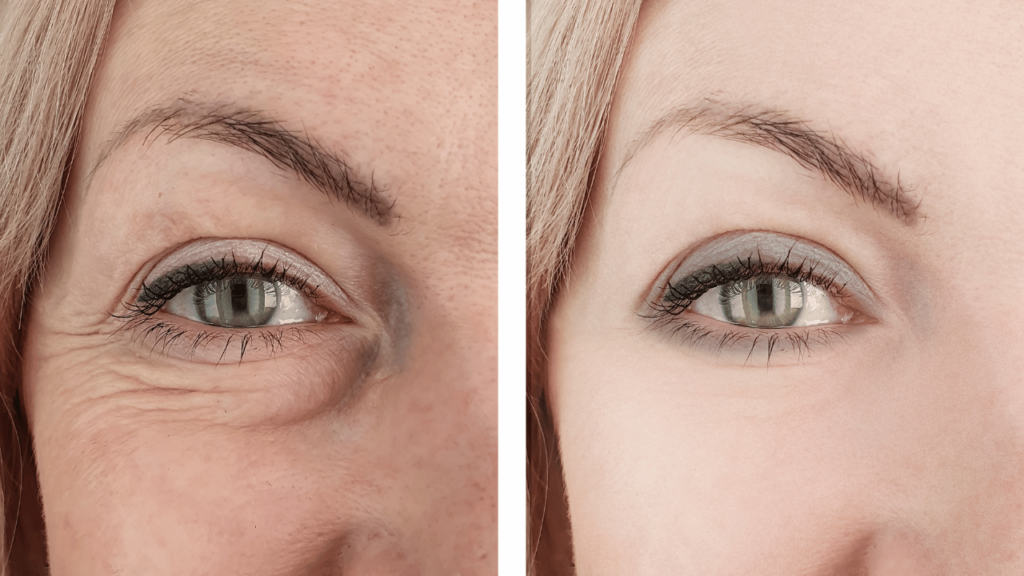 Close-up before and after comparison showing under-eye creasing versus smooth concealer application